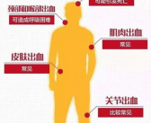 血友病的症状,揭秘罕见遗传性出血疾病的症状与挑战